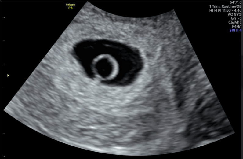 #16 Pregnancy Update – September&nbsp;20th